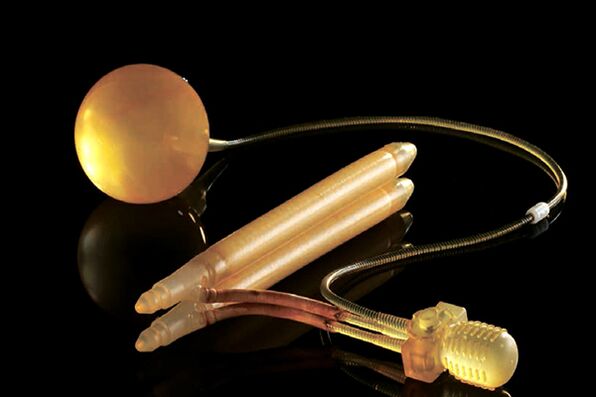 Prótesis hinchable para alargamiento quirúrgico del pene