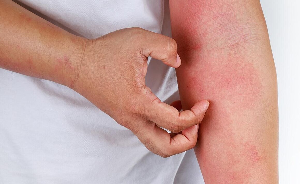 posibles complicaciones por el uso de refrescos