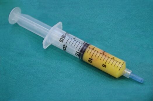 Jeringa con tejido adiposo para lipofilling